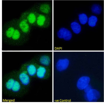 p53 Chimeric Antibody in Immunocytochemistry (ICC/IF)