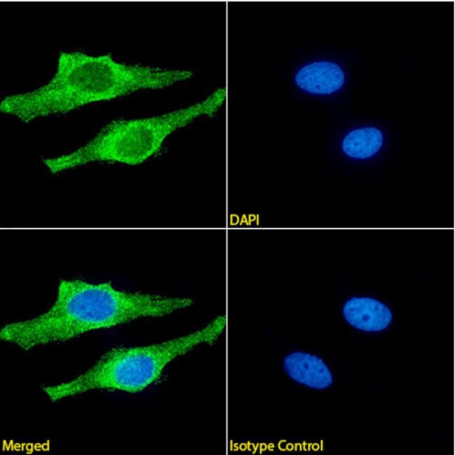 beta Amyloid (1-42) Chimeric Antibody in Immunocytochemistry (ICC/IF)