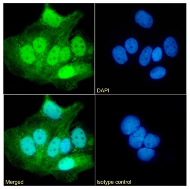 UBE2C Antibody in Immunocytochemistry (ICC/IF)