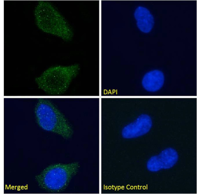 Tau Antibody in Immunocytochemistry (ICC/IF)