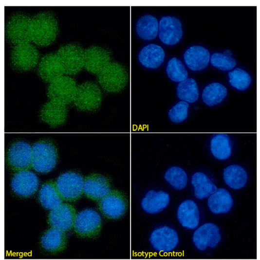 S100A9 Antibody in Immunocytochemistry (ICC/IF)