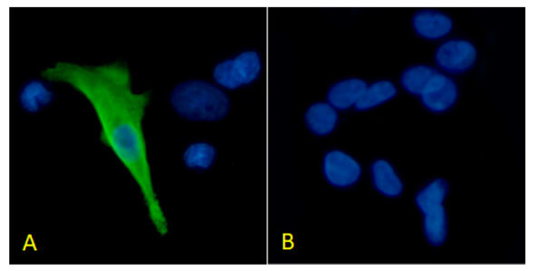 Protein C Antibody in Immunocytochemistry (ICC/IF)