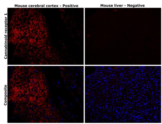 Cannabinoid Receptor 1 Antibody in Immunohistochemistry (Paraffin) (IHC (P))