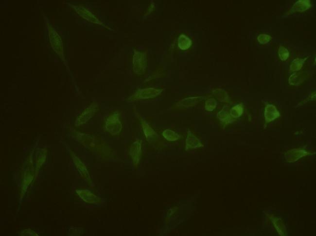 VEGF Receptor 1 Antibody in Immunocytochemistry (ICC/IF)