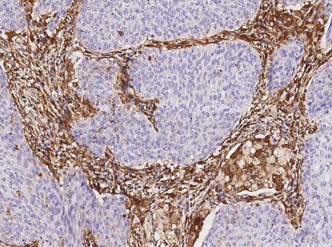 Galectin 1 Antibody in Immunohistochemistry (Paraffin) (IHC (P))