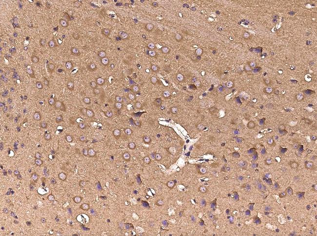 GP130 Antibody in Immunohistochemistry (Paraffin) (IHC (P))