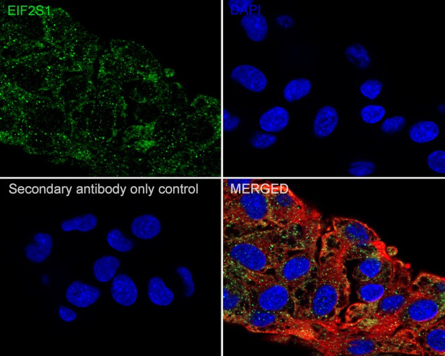 EIF2S1 Antibody in Immunocytochemistry (ICC/IF)