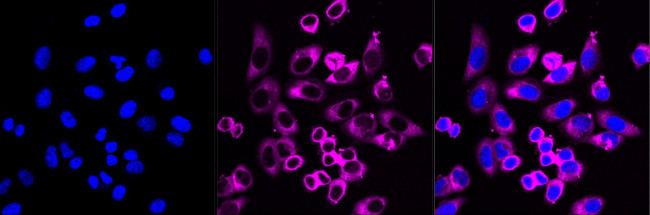 PUMA alpha Antibody in Immunocytochemistry (ICC/IF)