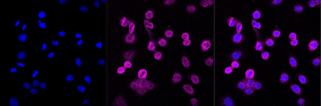 ROCK1 Antibody in Immunocytochemistry (ICC/IF)