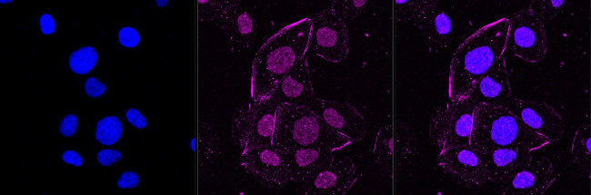 PSMB10 Antibody in Immunocytochemistry (ICC/IF)