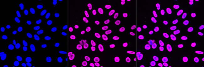 NEDD4 Antibody in Immunocytochemistry (ICC/IF)