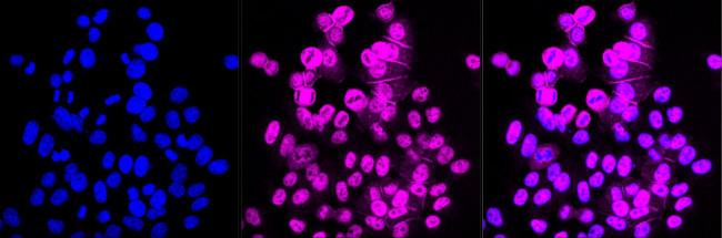 HIPK2 Antibody in Immunocytochemistry (ICC/IF)