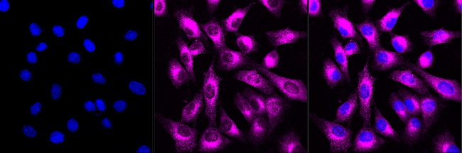 LRP1 Antibody in Immunocytochemistry (ICC/IF)