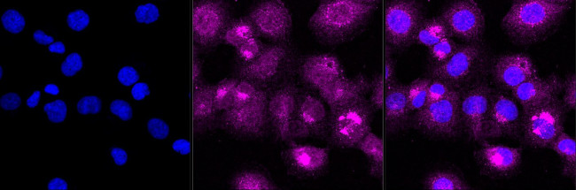 PKM2 Antibody in Immunocytochemistry (ICC/IF)