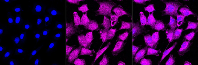 SETD8 Antibody in Immunocytochemistry (ICC/IF)