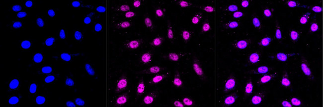 CPSF3 Antibody in Immunocytochemistry (ICC/IF)