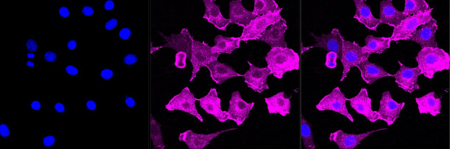 Aquaporin 5 Antibody in Immunocytochemistry (ICC/IF)