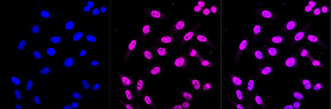 CPEB1 Antibody in Immunocytochemistry (ICC/IF)