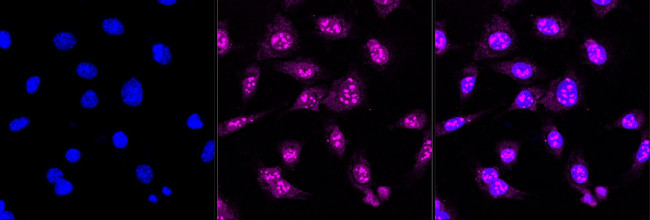 CENPC Antibody in Immunocytochemistry (ICC/IF)