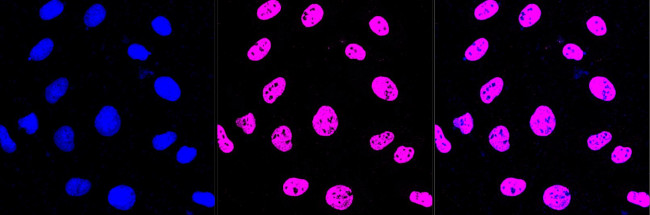 CYP24A1 Antibody in Immunocytochemistry (ICC/IF)