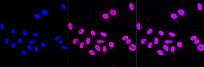 alpha Actinin 3 Antibody in Immunocytochemistry (ICC/IF)