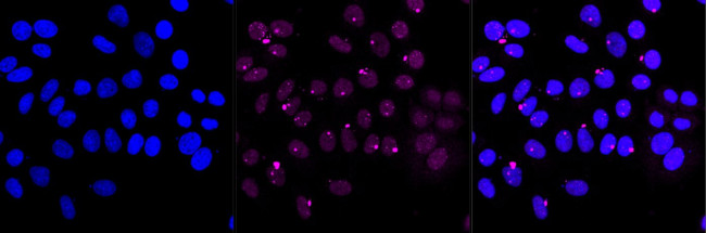 RSK2 Antibody in Immunocytochemistry (ICC/IF)