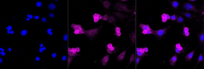 ATG4A Antibody in Immunocytochemistry (ICC/IF)