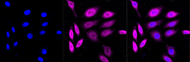 CAD Antibody in Immunocytochemistry (ICC/IF)