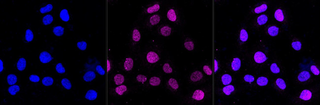 Caspase 5 Antibody in Immunocytochemistry (ICC/IF)