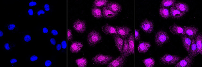 Cdc34 Antibody in Immunocytochemistry (ICC/IF)