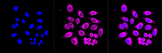 ELOVL5 Antibody in Immunocytochemistry (ICC/IF)