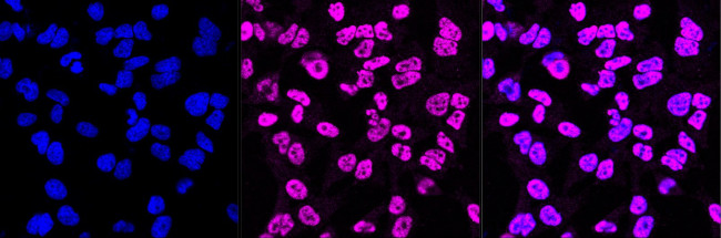 XPD Antibody in Immunocytochemistry (ICC/IF)