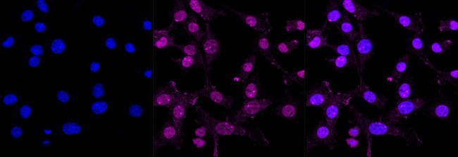 Apolipoprotein F Antibody in Immunocytochemistry (ICC/IF)