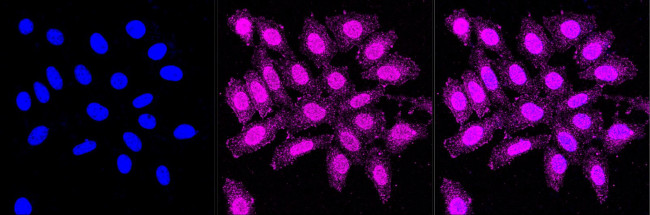 C4BPB Antibody in Immunocytochemistry (ICC/IF)