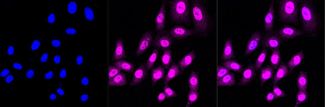 CDC123 Antibody in Immunocytochemistry (ICC/IF)