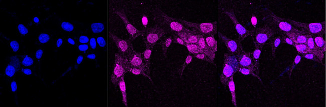 Creatine Kinase BB Antibody in Immunocytochemistry (ICC/IF)