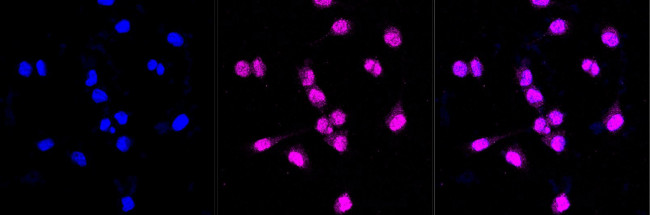 SKP1 Antibody in Immunocytochemistry (ICC/IF)