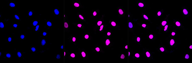 SMARCA5 Antibody in Immunocytochemistry (ICC/IF)