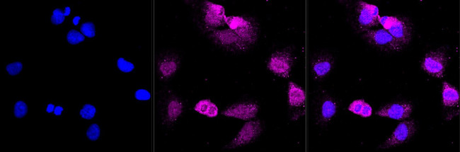 Cullin 3 Antibody in Immunocytochemistry (ICC/IF)