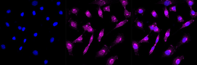 Alcohol Dehydrogenase 1A Antibody in Immunocytochemistry (ICC/IF)