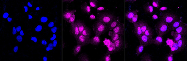 ATG7 Antibody in Immunocytochemistry (ICC/IF)