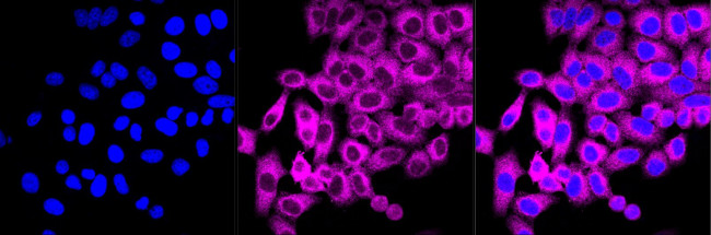 ATG3 Antibody in Immunocytochemistry (ICC/IF)