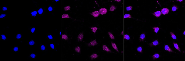 ATOH1 Antibody in Immunocytochemistry (ICC/IF)