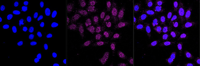 SERCA1 ATPase Antibody in Immunocytochemistry (ICC/IF)