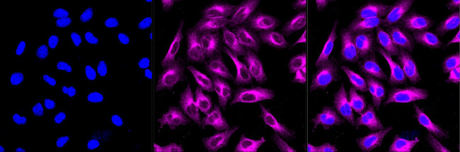 CaMKII Pan Antibody in Immunocytochemistry (ICC/IF)