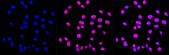 Phospho-C-Jun/D-Jun (Ser73, Ser100) Antibody in Immunocytochemistry (ICC/IF)