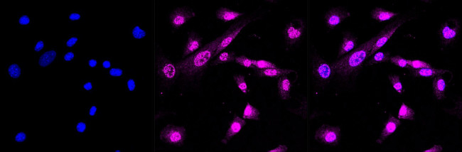 Phospho-ERK1/ERK2 (Thr202, Thr185) Antibody in Immunocytochemistry (ICC/IF)