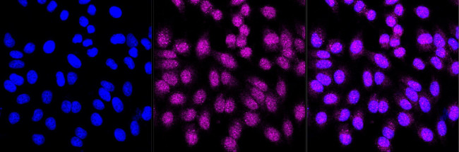 TEAD1/2/3/4 Antibody in Immunocytochemistry (ICC/IF)