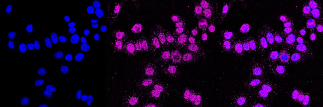 AXIN2 Antibody in Immunocytochemistry (ICC/IF)