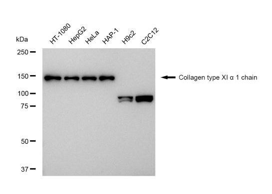 COL11A1 Antibody in Western Blot (WB)